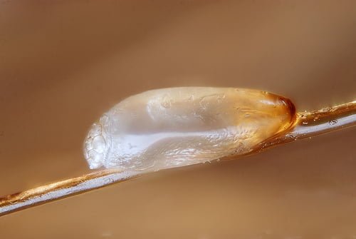 Head lice nit close-up